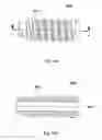 Fig. 53 - Implant placement systems, devices and methods