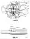 Fig. 16 - Endoscopic stitching devices