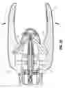 Fig. 17 - Endoscopic stitching devices