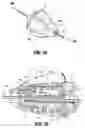 Fig. 36 - Endoscopic stitching devices