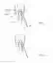 Fig. 14 - Suture sleeve patch and methods of delivery within an existing arthroscopic workflow
