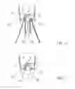 Fig. 18 - Suture sleeve patch and methods of delivery within an existing arthroscopic workflow
