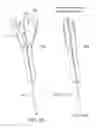 Fig. 45 - Suture sleeve patch and methods of delivery within an existing arthroscopic workflow