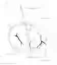 Fig. 03 - Tissue protection device for mitral valve membrane cerclage procedure