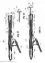 Fig. 35 - Ratcheting mechanism for surgical stapling device
