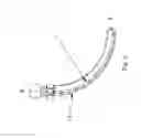 Fig. 04 - FIXATION IMPLANT AND METHOD OF INSERTION
