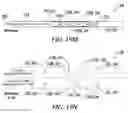 Fig. 23 - Clot retrieval system