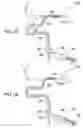 Fig. 28 - Clot retrieval system