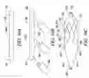 Fig. 35 - Clot retrieval system