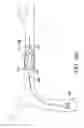 Fig. 43 - Clot retrieval system