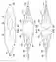 Fig. 45 - Clot retrieval system