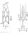 Fig. 69 - Clot retrieval system