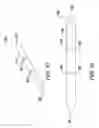 Fig. 79 - Clot retrieval system