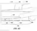 Fig. 95 - Clot retrieval system