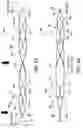 Fig. 96 - Clot retrieval system