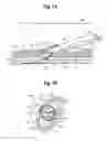 Fig. 02 - CUTTING DEVICE WITH PRECISE CUTTING DEPTH