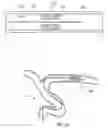 Fig. 03 - Devices and systems for thrombus treatment