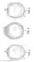 Fig. 03 - Rotational Atherectomy Device