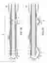 Fig. 09 - Rotational Atherectomy Device