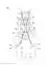Fig. 01 - Percutaneous methods for spinal stenosis and foraminal stenosis