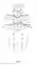Fig. 02 - Percutaneous methods for spinal stenosis and foraminal stenosis
