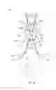 Fig. 09 - Percutaneous methods for spinal stenosis and foraminal stenosis