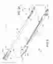 Fig. 03 - Percuscopic access device and cleaning obturator