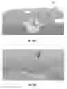 Fig. 16 - Method and apparatus for minimally invasive insertion of intervertebral implants