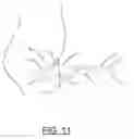 Fig. 12 - Prosthetic Artificial Insemination Device