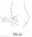 Fig. 13 - Prosthetic Artificial Insemination Device
