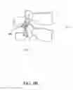 Fig. 05 - Spine stabilization device