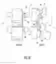 Fig. 08 - Spine stabilization device