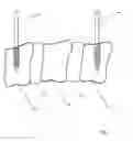 Fig. 02 - Alignment guide for cervical spine plate