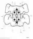 Fig. 09 - Alignment guide for cervical spine plate