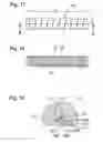 Fig. 07 - Implant for bones or vertebrae with self-constrained flexibility
