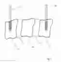 Fig. 02 - Alignment guide for cervical spine plate