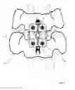 Fig. 09 - Alignment guide for cervical spine plate