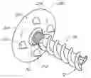 Fig. 01 - Method and apparatus for sacroiliac joint fixation