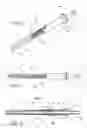 Fig. 03 - Method and apparatus for sacroiliac joint fixation