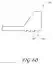 Fig. 10 - Method and apparatus for sacroiliac joint fixation