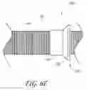 Fig. 11 - Method and apparatus for sacroiliac joint fixation