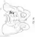 Fig. 19 - Method and apparatus for sacroiliac joint fixation