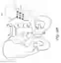 Fig. 20 - Method and apparatus for sacroiliac joint fixation