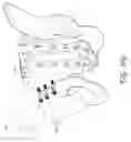Fig. 23 - Method and apparatus for sacroiliac joint fixation