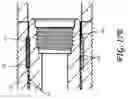 Fig. 29 - Method and apparatus for sacroiliac joint fixation