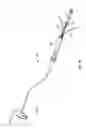 Fig. 17 - Ablation method for creating elongate continuous lesions enclosing multiple vessel entries