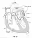 Fig. 29 - Ablation method for creating elongate continuous lesions enclosing multiple vessel entries