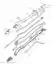 Fig. 01 - Device For Cutting Off And Removing Calcified Tissue From A Heart Valve