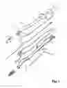 Fig. 02 - Device For Cutting Off And Removing Calcified Tissue From A Heart Valve