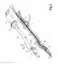 Fig. 03 - Device For Cutting Off And Removing Calcified Tissue From A Heart Valve